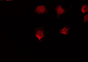 FKRP Antibody (N-Terminal)
