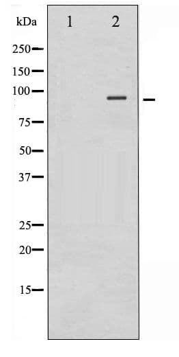 CTNNB1 / Beta Catenin Antibody (phospho-Ser37)