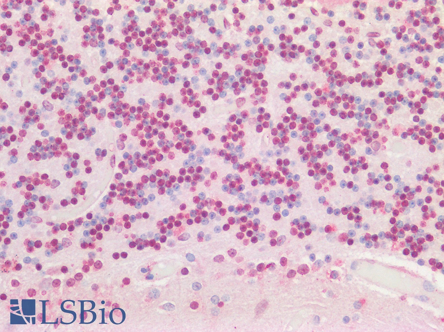 AATF Antibody (aa171-220)