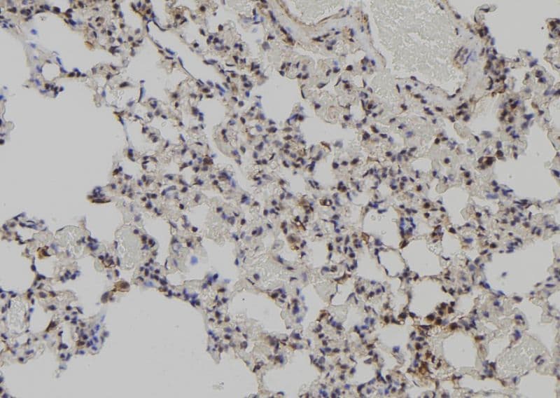 MAGED2 Antibody