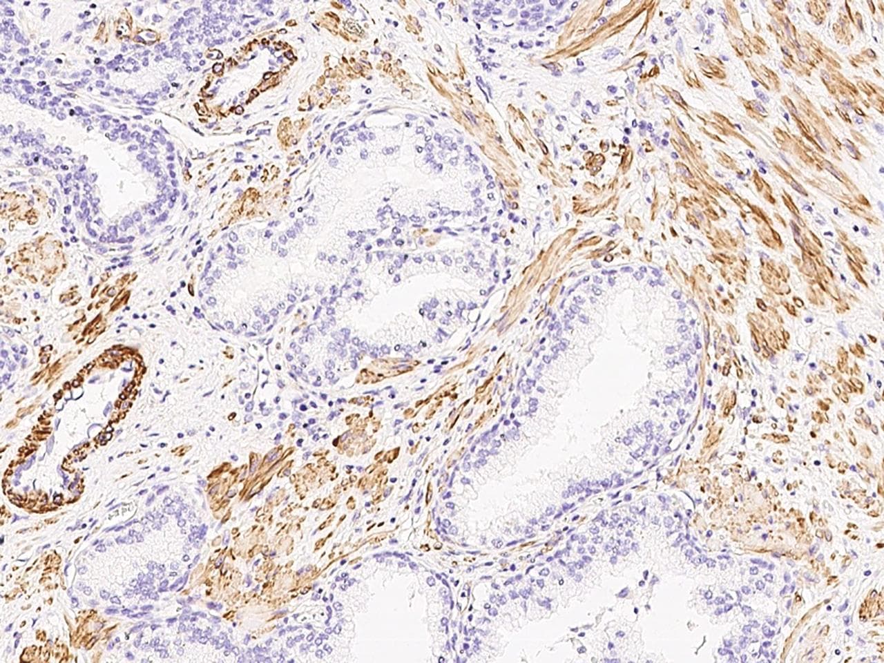 CALD1 / Caldesmon Antibody (Preservative Free)