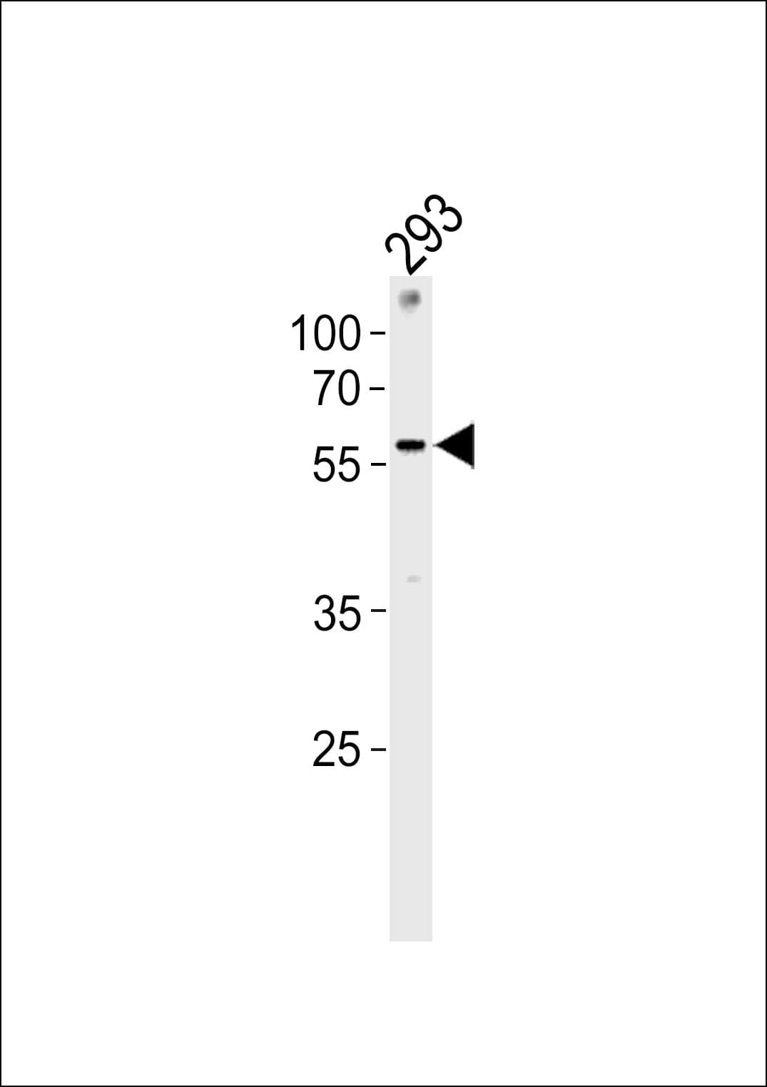 ZNF76 Antibody (aa388-415)