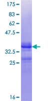 Human GPR48 / LGR4 Protein (Recombinant GST, N-terminus)