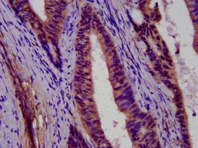 Polyclonal Rabbit anti-Human PCDH11X / Protocadherin 11 Antibody (aa987-1117, IHC, IF)