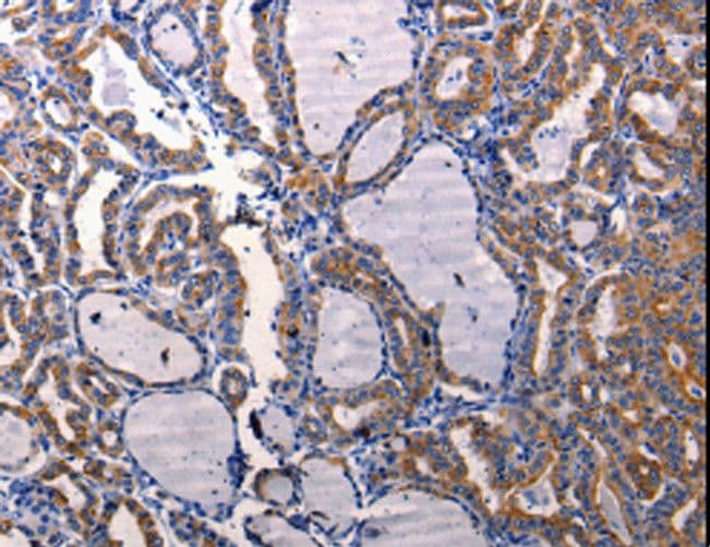 DRD1 / Dopamine Receptor D1 Antibody