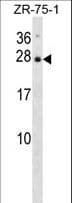IL25 / IL17E Antibody (aa76-104)