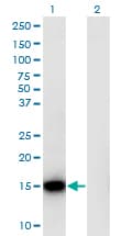 Monoclonal Mouse anti-Human RPLP1 Antibody (clone 1G10, IF, WB)
