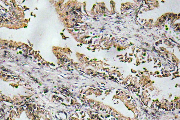 NTF4 / Neurotrophin 4 Antibody (Val120)
