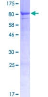 Human GRK7 / GPRK7 Protein (Recombinant GST)
