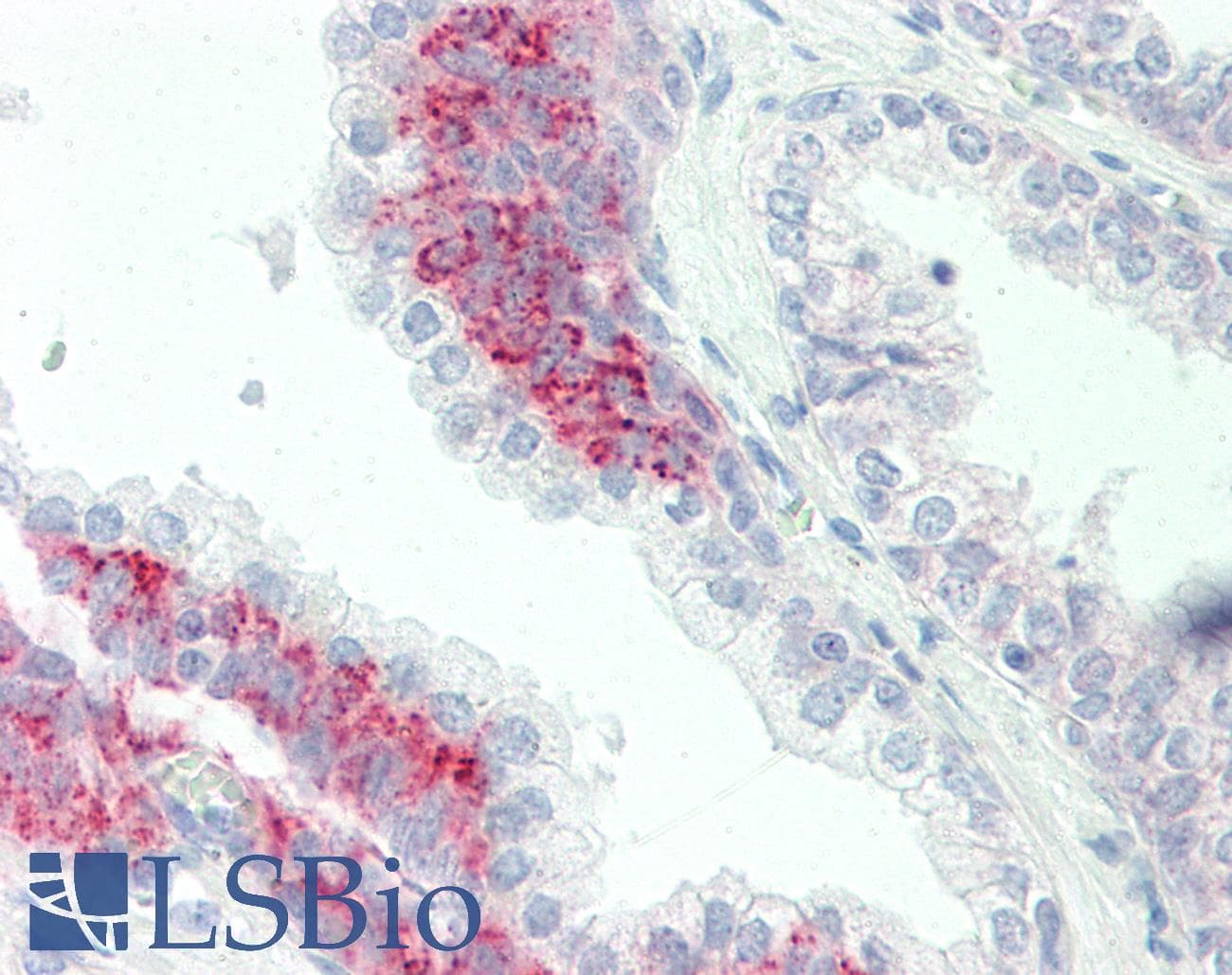 IHC-plus™ PAK4 Antibody (aa187-216)