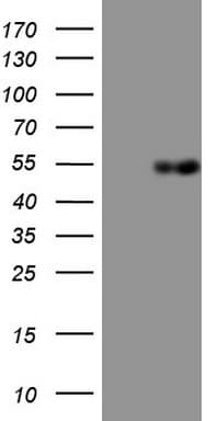 Monoclonal Mouse anti-Human APOH / Apolipoprotein H Antibody (clone OTI2C9, aa120-345, IHC, WB)