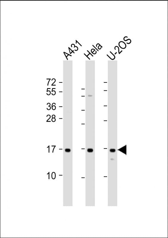 RPLP1 Antibody (aa18-49)