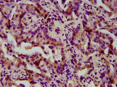 Polyclonal Rabbit anti-Human TIMELESS Antibody (IHC)