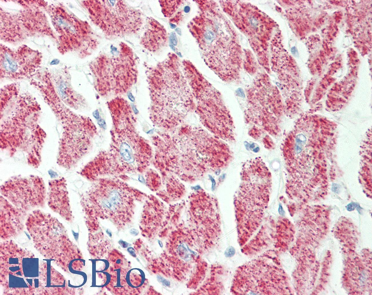 IHC-plus™ GLRX3 / Glutaredoxin 3 Antibody (aa81-110)
