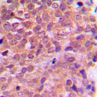 PRKAB1 / AMPK Beta 1 Antibody (N-Terminus)