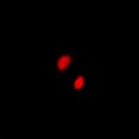 Polyclonal Rabbit anti-Human CXXC1 / CGBP Antibody (IHC, IF, WB)