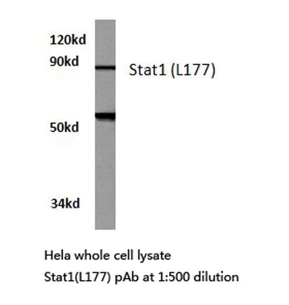 Polyclonal Rabbit anti-Human STAT1 Antibody (Leu177, IHC, WB)
