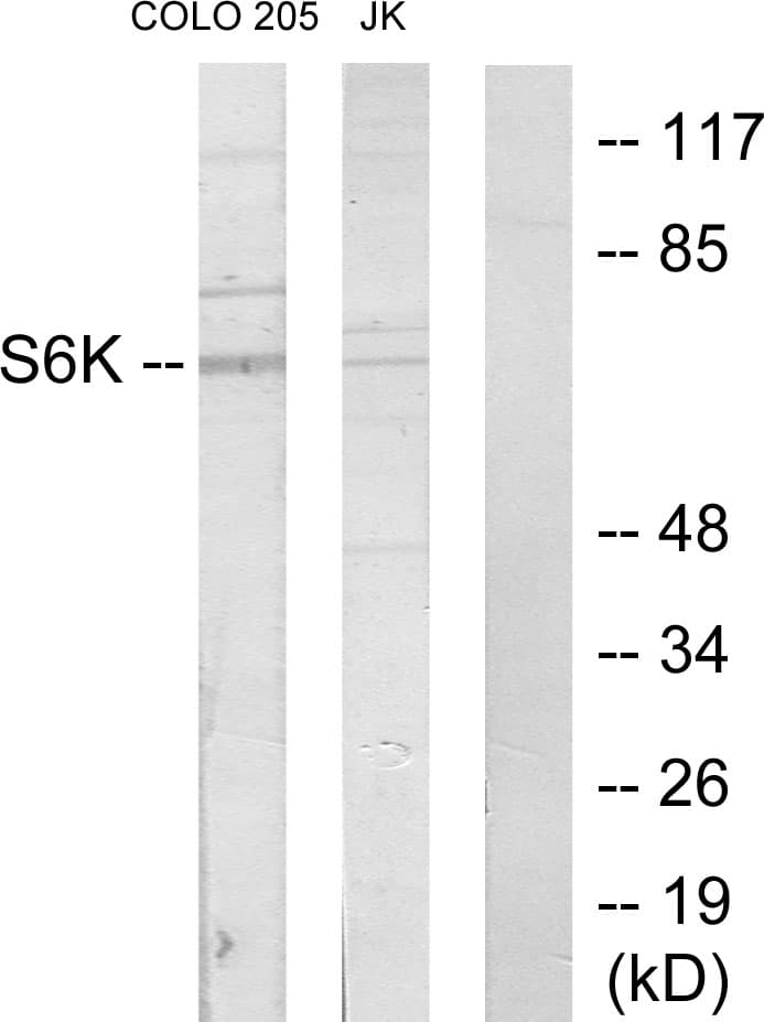IHC-plus™ RPS6KB1 / P70S6K / S6K Antibody (aa261-310)