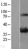 Human LDHA / LDH1 Protein (Over-Expression Lysate Myc-DDK (Flag))