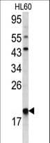 p21-ARC / ARPC3 Antibody (aa131-158)