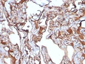 MCAM / CD146 Antibody (clone MUC18/1130)