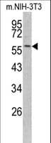 KRT14 / CK14 / Cytokeratin 14 Antibody (aa276-303)