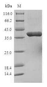 Human STOM / Stomatin Protein (Recombinant 6His-SUMO, N-terminus)