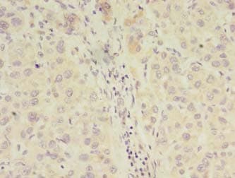 CLASP2 Antibody