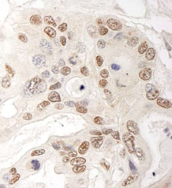 QSER1 Antibody (aa1407-1457)