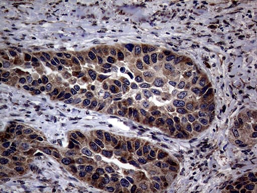 PITPNB Antibody (clone OTI5D11)