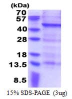 Human MAGEB10 Protein (Recombinant His)