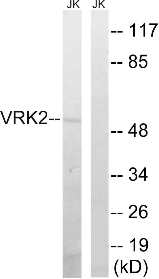 VRK2 Antibody (aa171-220)