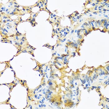 TSHB / TSH-Beta Antibody