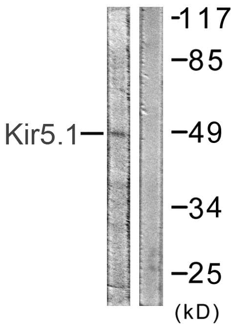 KCNJ16 / Kir5.1 Antibody (p416)