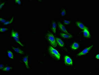 Polyclonal Rabbit anti-Human HAX-1 Antibody (IHC, WB)