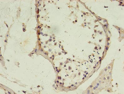 MSH6 Antibody (aa1-400)