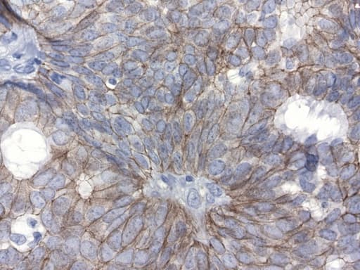 CDH1 / E Cadherin Antibody (clone UMAB184)