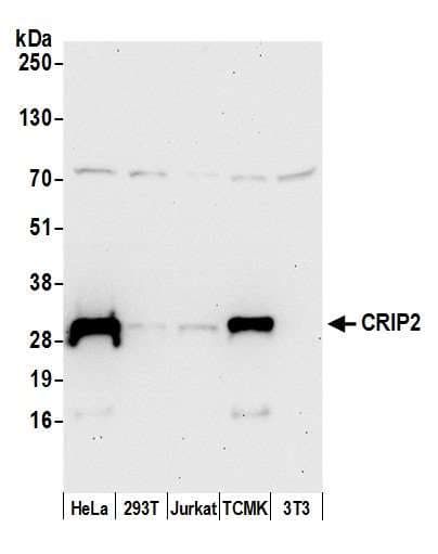 CRIP2 Antibody (aa158-208)
