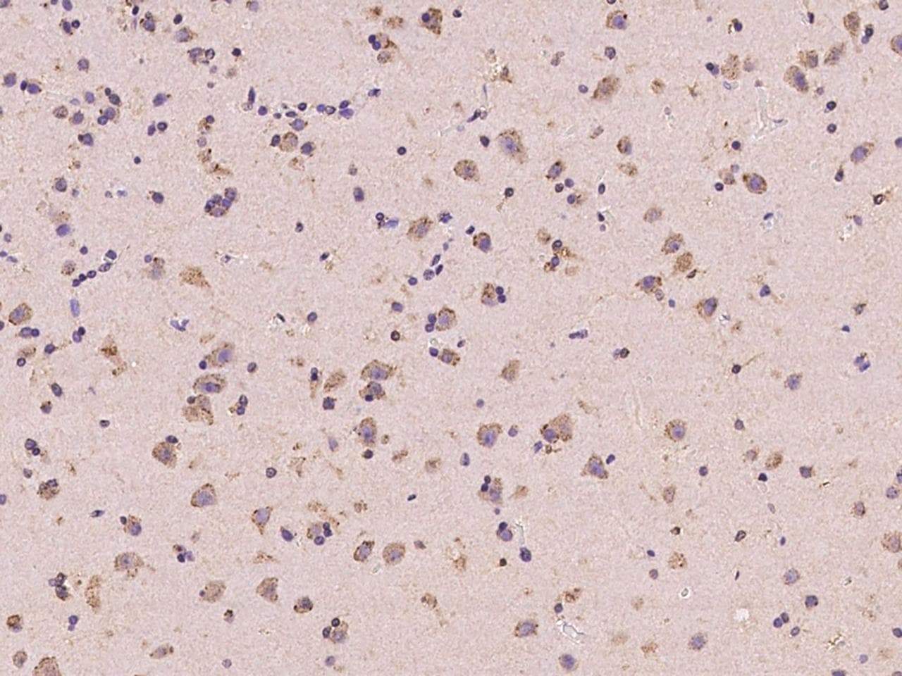 ANKS6 Antibody