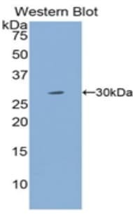 MYH4 Antibody (aa1633-1875, PE)