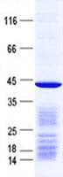 Human PSMC6 Protein (Recombinant His, N-Terminal)