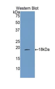 ALOX15 / 15-Lipoxygenase Antibody (aa170-312)