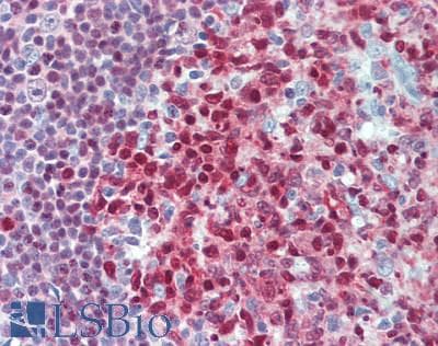 IHC-plus™ Polyclonal Rabbit anti-Human DCK / Deoxycytidine kinase Antibody (aa210-260, IHC, WB)
