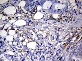 RASGRP3 / GRP3 Antibody (aa380-690, clone OTI2C11)