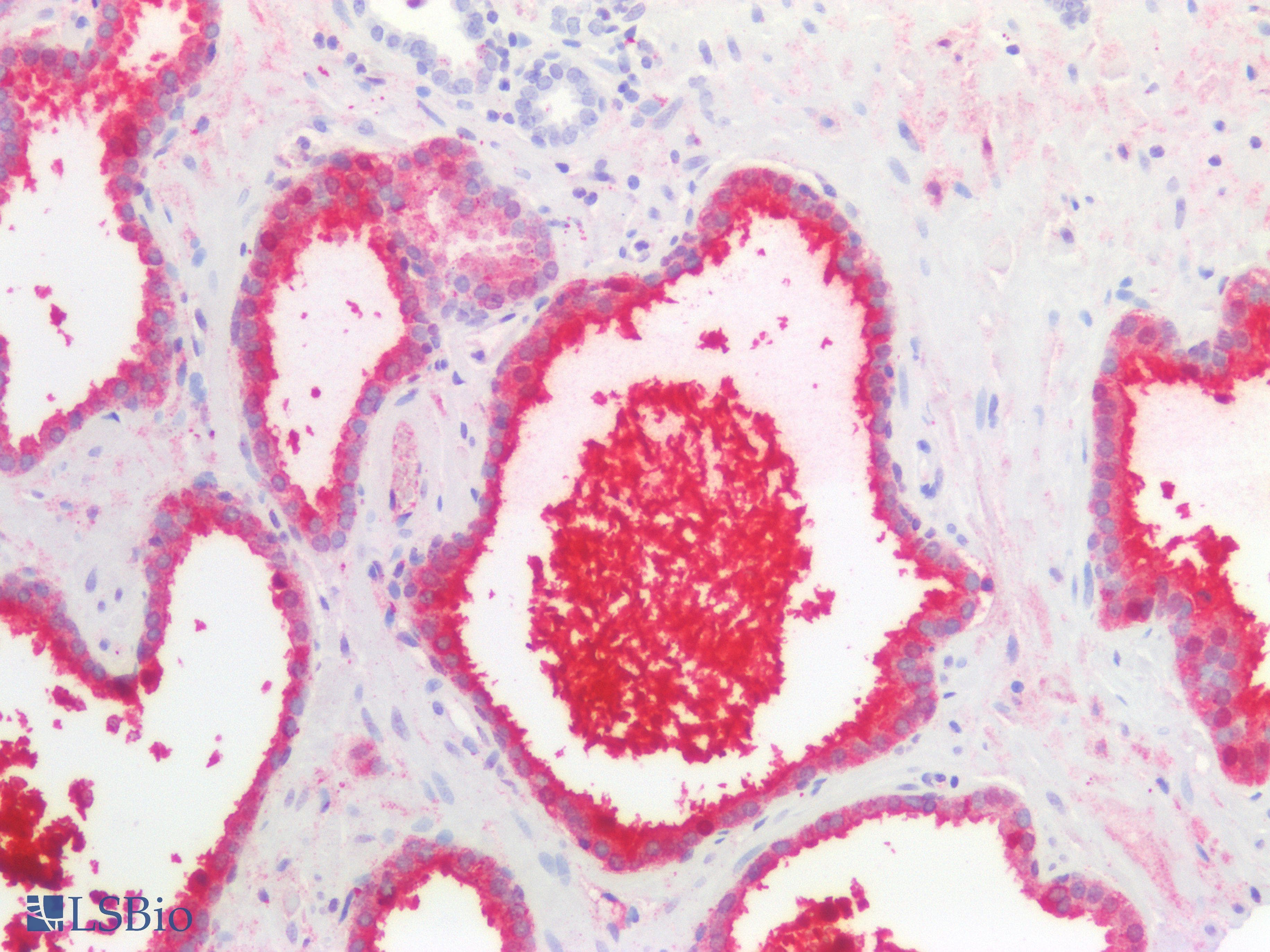 KLK3 / PSA Antibody (clone A67-B/E3)
