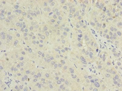 Polyclonal Rabbit anti-Human NME7 Antibody (aa1-150, IHC, WB)