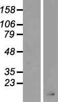 AGRP Protein (Over-Expression Lysate Myc-DDK (Flag))