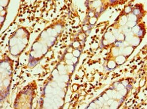 RAB4A / RAB4 Antibody (aa1-218)