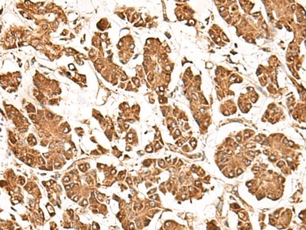 ZBTB43 Antibody