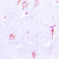 Polyclonal Rabbit anti-Human CTSE / Cathepsin E Antibody (Internal, IHC, WB)